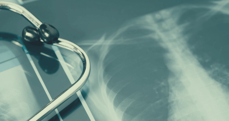 découvrez comment détecter et éliminer l'amiante dans votre maison pour protéger la santé de votre famille et assurer un environnement sûr.